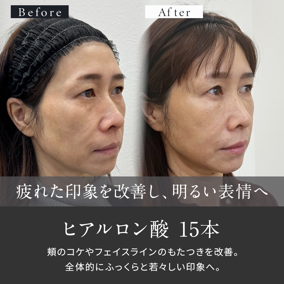 症例