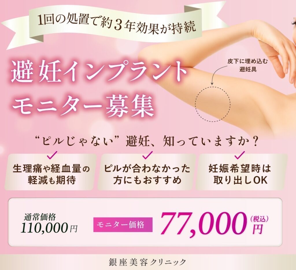 避妊インプラント