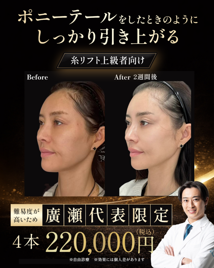 ポニーテールリフト