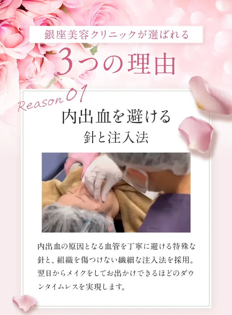 銀座美容クリニックが選ばれる3つの理由 Reason 01 内出血を避ける針と注入法。ダウンタイムレスを実現します。