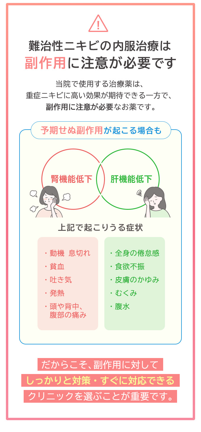 ニキビ治療薬の内服治療は副作用に注意が必要