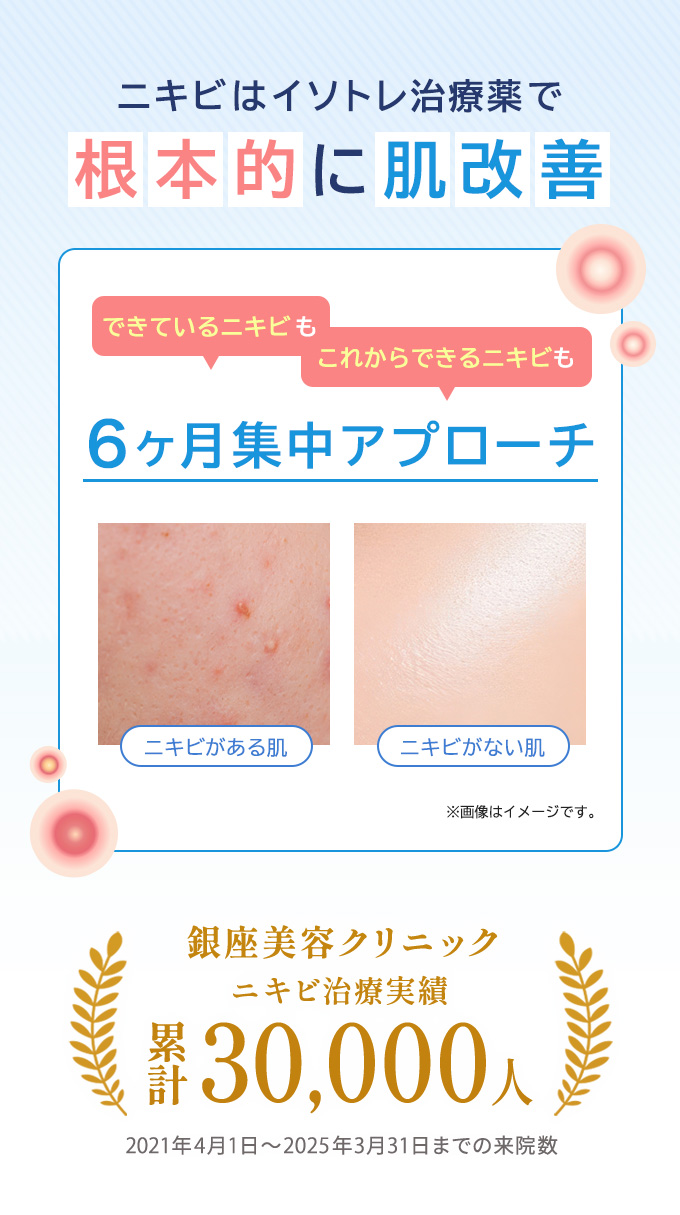 当院のニキビ治療実績は累計30,000人