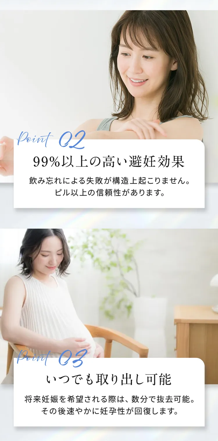 point02 「99％以上の高い避妊効果」
飲み忘れによる失敗が構造上起こりません。ピル以上の信頼性があります。

point03 「いつでも取り出し可能」
将来妊娠を希望される際は、数分で抜去可能。その後速やかに妊孕性が回復します。